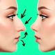 Neuscorrectie - Foto-editor icon