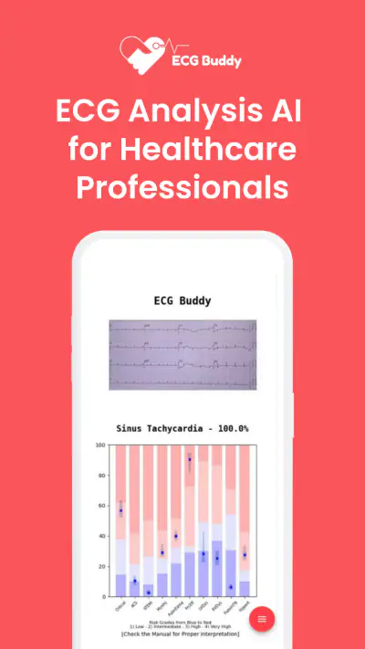 ECG Buddy | ECG Analysis AI screenshot 1