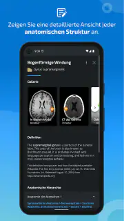IMAIOS e-Anatomy screenshot 5