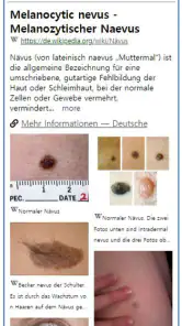 Model Dermatol – Hautkrankheit screenshot