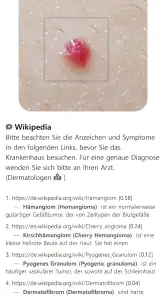 Model Dermatol – Hautkrankheit screenshot