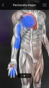 Muskel Triggerpunkte Anatomie screenshot