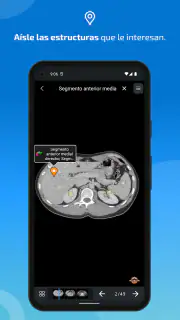 IMAIOS e-Anatomy screenshot 4