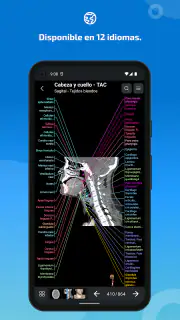 IMAIOS e-Anatomy screenshot 7