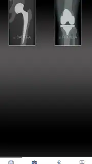 Mi prótesis screenshot 5