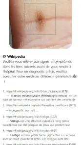 Model Derm – Maladie de peau screenshot