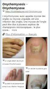 Model Derm – Maladie de peau screenshot