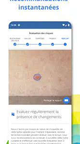 SkinVision screenshot