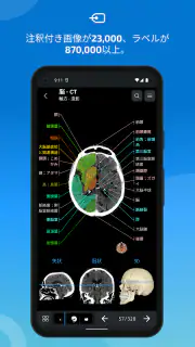 IMAIOS e-Anatomy screenshot 2