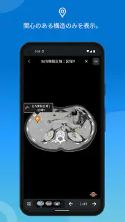 IMAIOS e-Anatomy screenshot 4