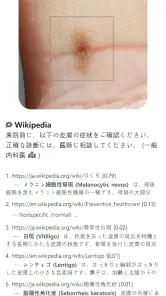 Model Dermatol – 皮膚疾患 screenshot