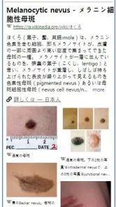 Model Dermatol – 皮膚疾患 screenshot