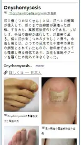 Model Dermatol – 皮膚疾患 screenshot