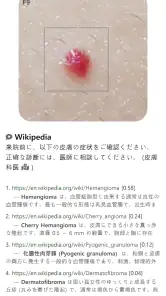 Model Dermatol – 皮膚疾患 screenshot