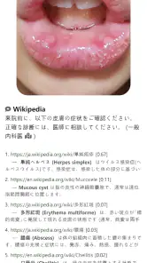 Model Dermatol – 皮膚疾患 screenshot