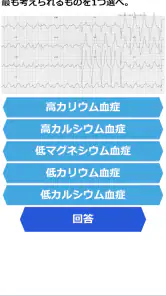 みんなde心電図 screenshot