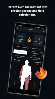 Anesthesia Calculator screenshot 8