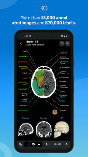 IMAIOS e-Anatomy screenshot 2