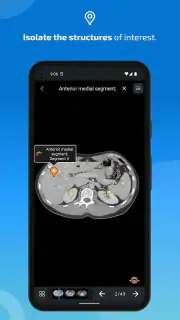 IMAIOS e-Anatomy screenshot 4