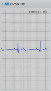Istel ECG screenshot 2