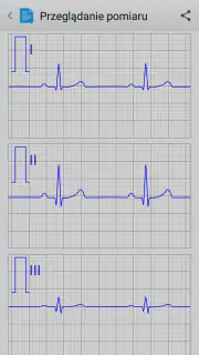 Istel ECG screenshot 3