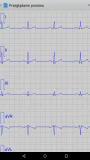 Istel ECG screenshot 4