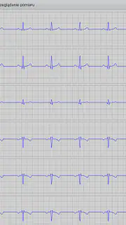 Istel ECG screenshot 5