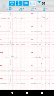 Norav Mobile ECG screenshot 4