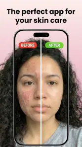 Skin Care Scanner: GlowUp screenshot