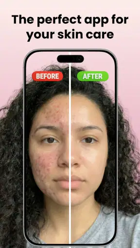 Skin Care Scanner: GlowUp screenshot 1
